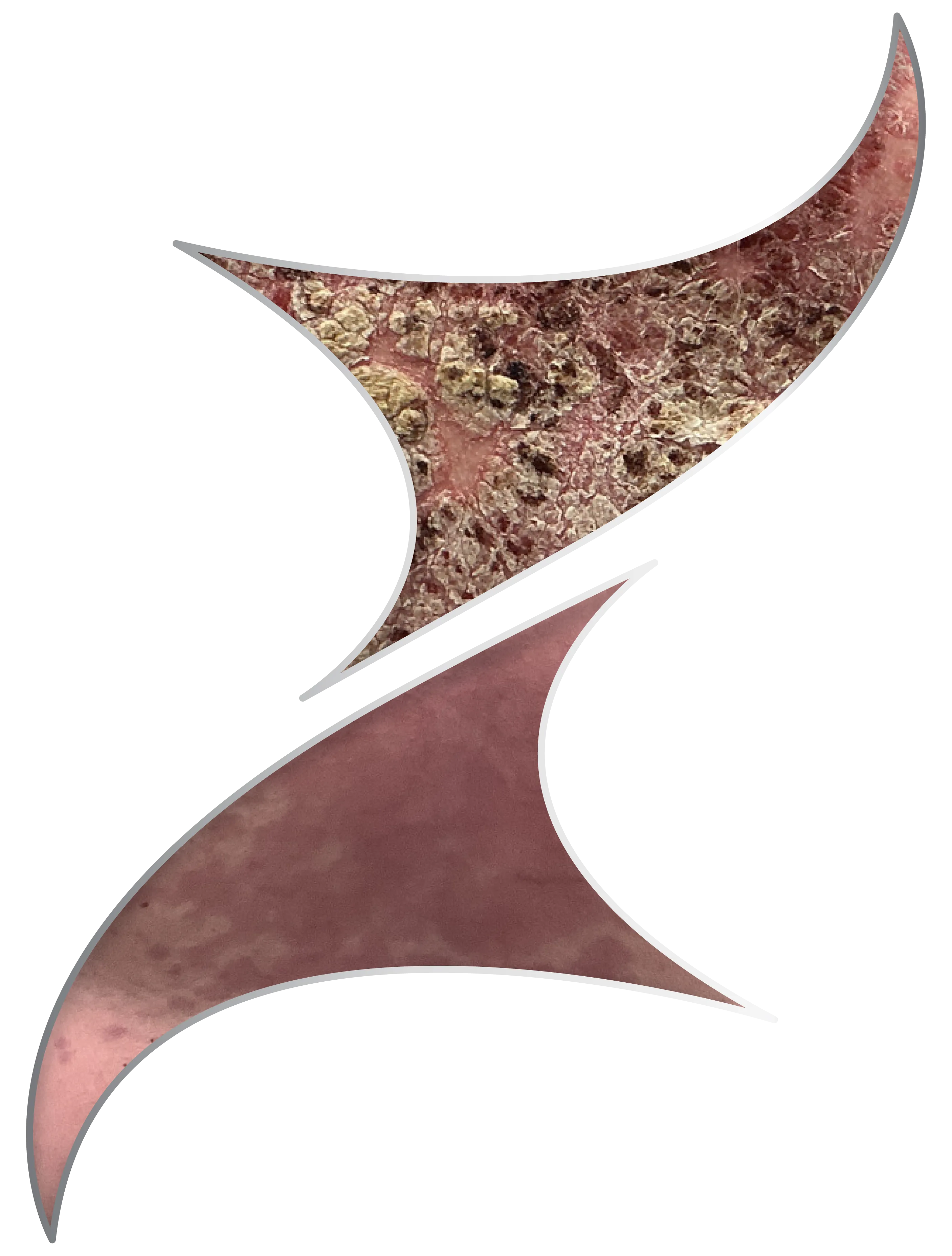 /
